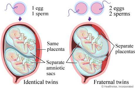体外受精 IVF-ET