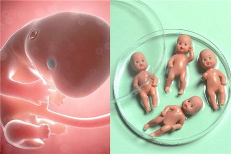 一般不妊検査・タイミング療法